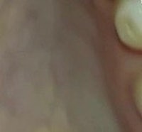 a close up of a person's teeth