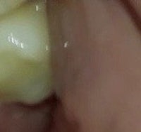 a close up of a person's mouth with a tooth in it